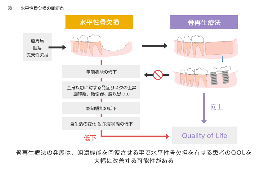 図1